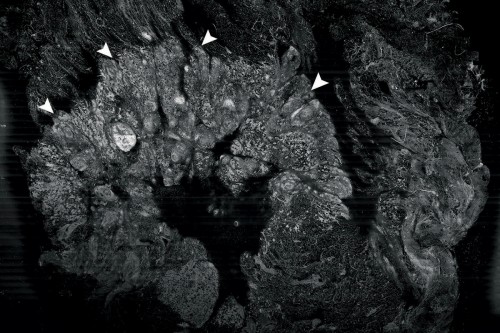 Pictured: A cross section of a piece of breast tumor tissue imaged by confocal mosaicking microscopy, a method Memorial Sloan Kettering researchers are developing to make pathology in the OR more effective. 