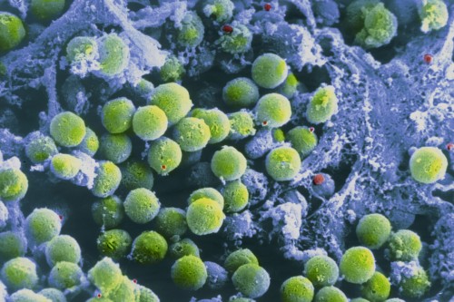 Pictured: Developing white blood cells called T cells on the surface of the thymus. T cells defend the body from foreign intruders such as bacteria, viruses, and fungi, and may also protect against cancer.