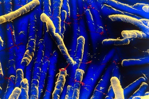 Pictured: Clostridium difficile, a bacterium that often infects cancer patients, imaged by scanning electron microscopy.  